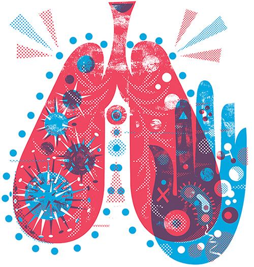 Colorful illustration of lungs with bacteria floating inside.